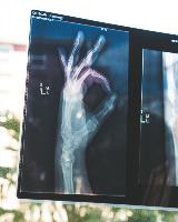 Ostéoporose : risques et prévention